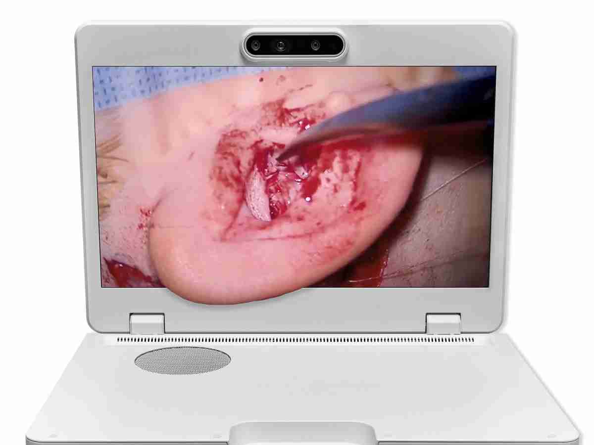 达擎之＂Heads-up 3D显微手术显示系统＂，，，整合4K裸眼3D显示及眼球追踪系统，，，具备快速追踪人眼移动位置功能，，，，减轻医师长时间维持固定姿势的负担，，让医师能有更宽广清晰的3D立体视野及更舒适的姿势来执行手术。。